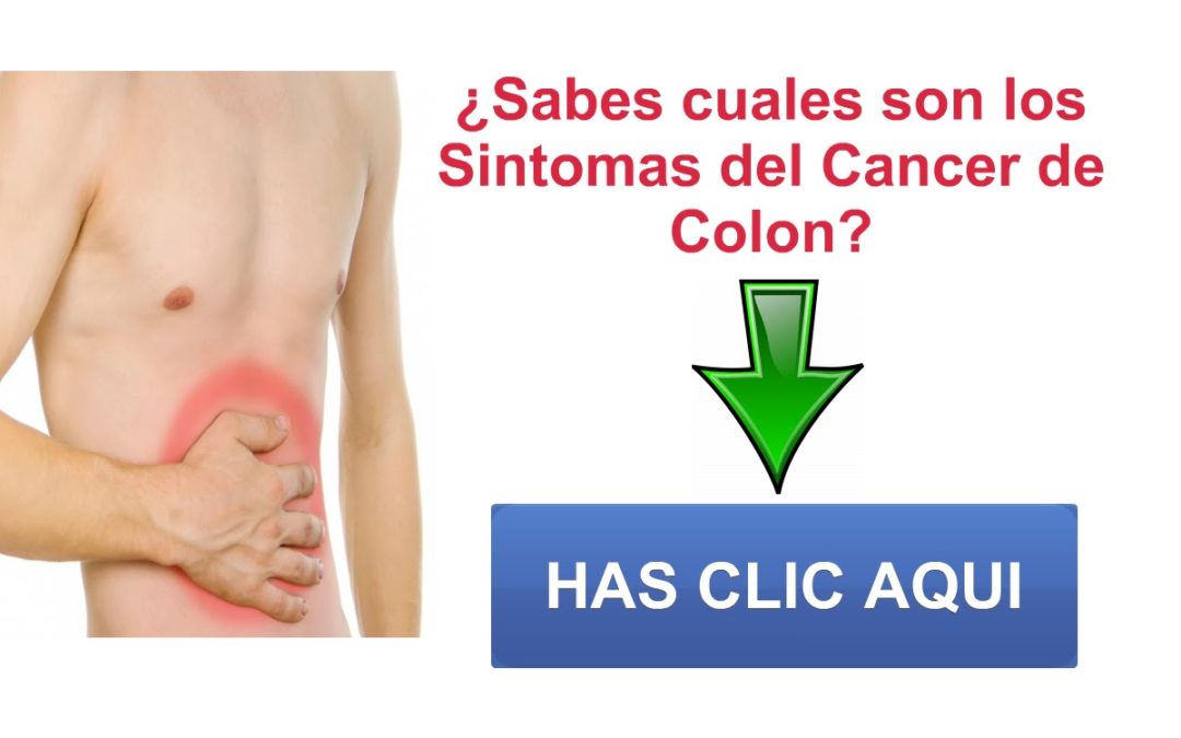 ¿Que es el cáncer de colon?